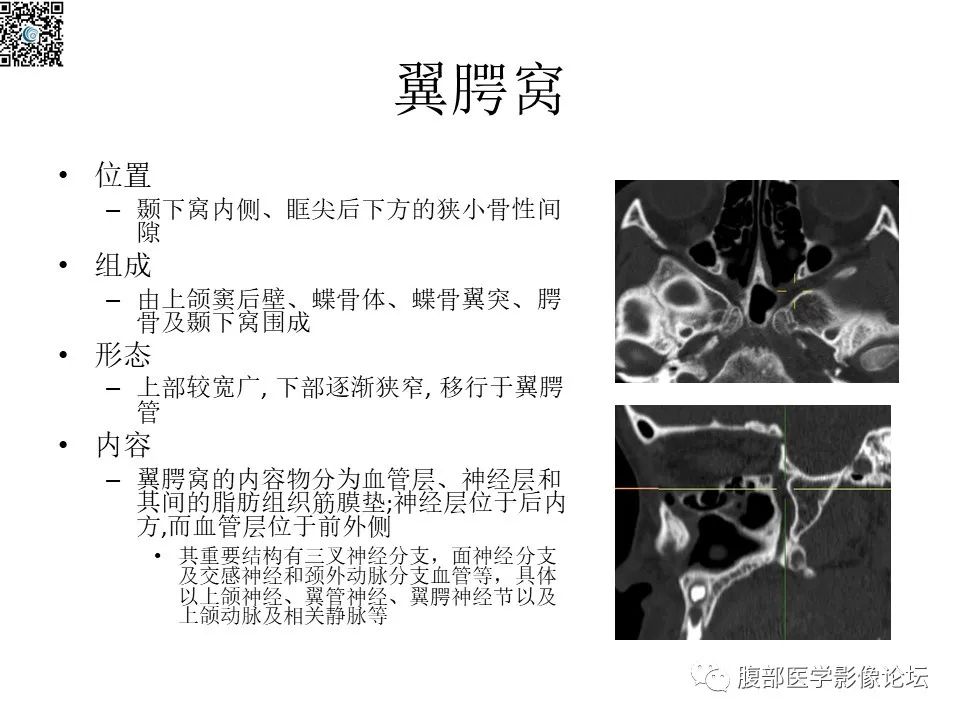 影像PPT - 【PPT】颅骨颅底系列之八面灵通翼腭窝-3