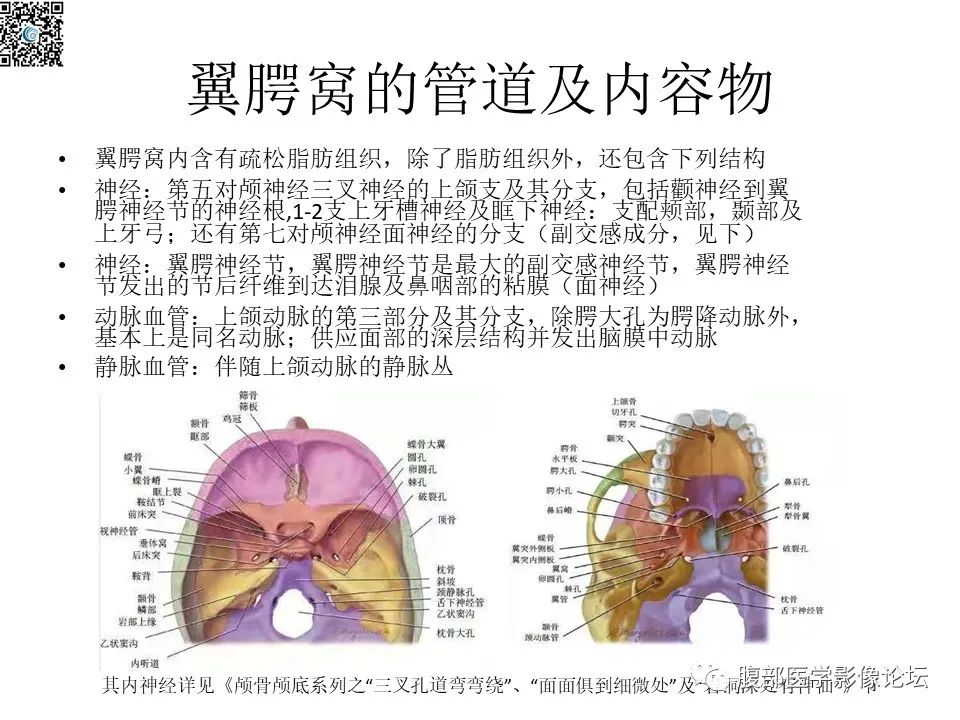 影像PPT - 【PPT】颅骨颅底系列之八面灵通翼腭窝-7