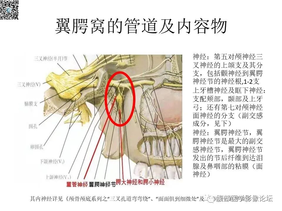 影像PPT - 【PPT】颅骨颅底系列之八面灵通翼腭窝-8