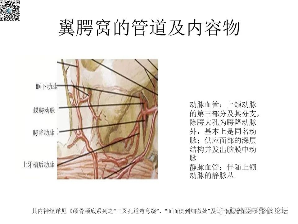 影像PPT - 【PPT】颅骨颅底系列之八面灵通翼腭窝-11