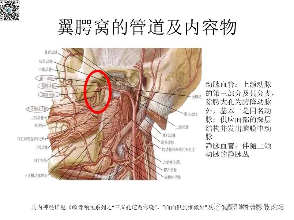 影像PPT - 【PPT】颅骨颅底系列之八面灵通翼腭窝-10