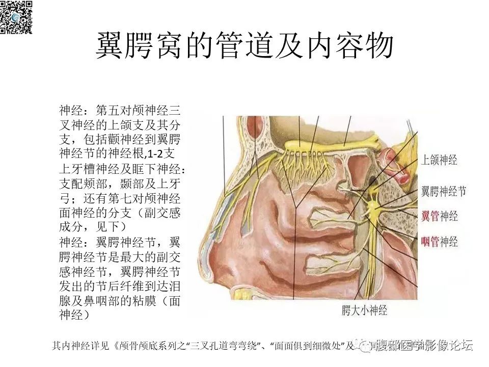 影像PPT - 【PPT】颅骨颅底系列之八面灵通翼腭窝-9
