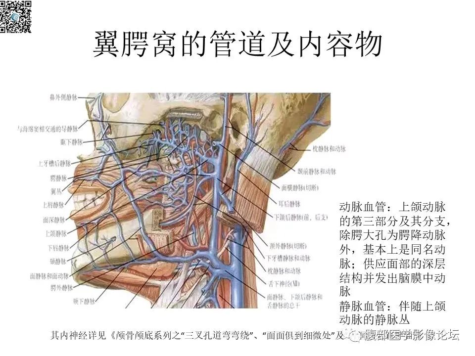 影像PPT - 【PPT】颅骨颅底系列之八面灵通翼腭窝-12
