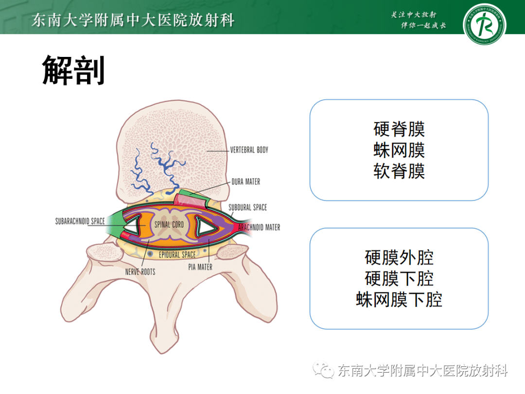 影像PPT - 【PPT】椎管内神经鞘瘤的影像-4