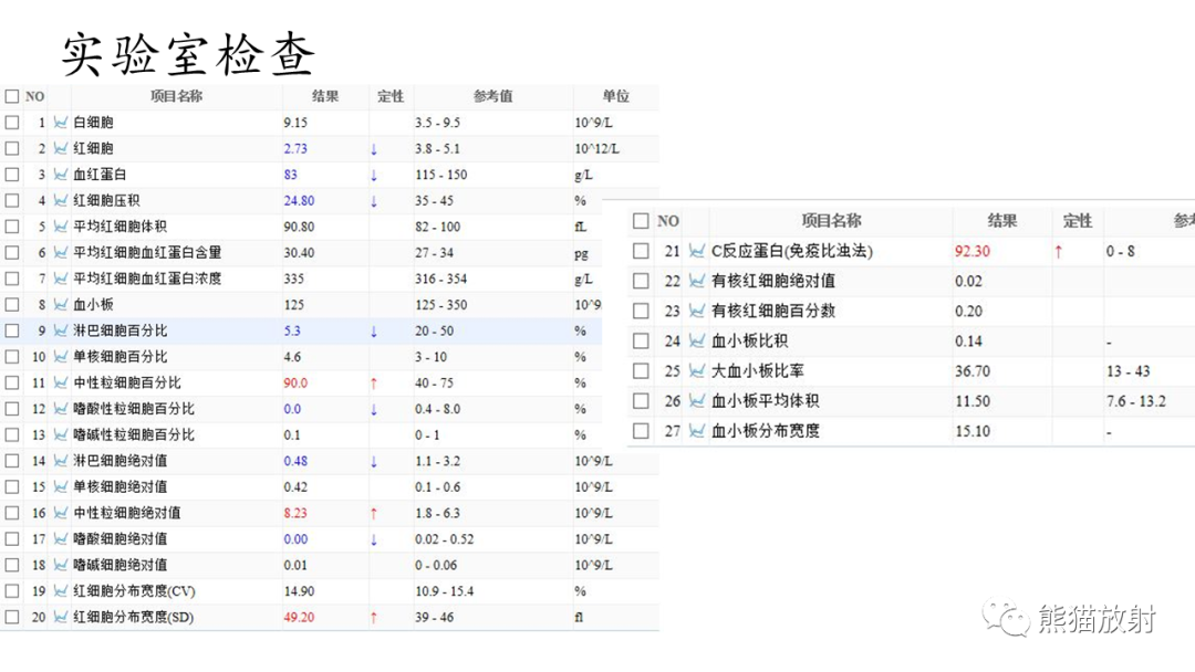 影像PPT - 【病例】髂骨孤立性浆细胞瘤VS骨巨细胞瘤-13