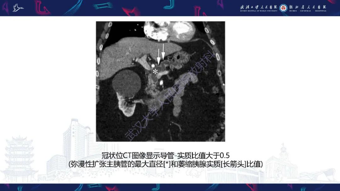 影像PPT - 【PPT】慢性胰腺炎与胰腺肿瘤影像鉴别诊断-16