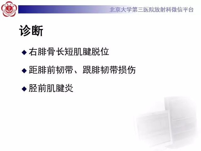 影像PPT - 【PPT】腓骨肌腱脱位的影像-8