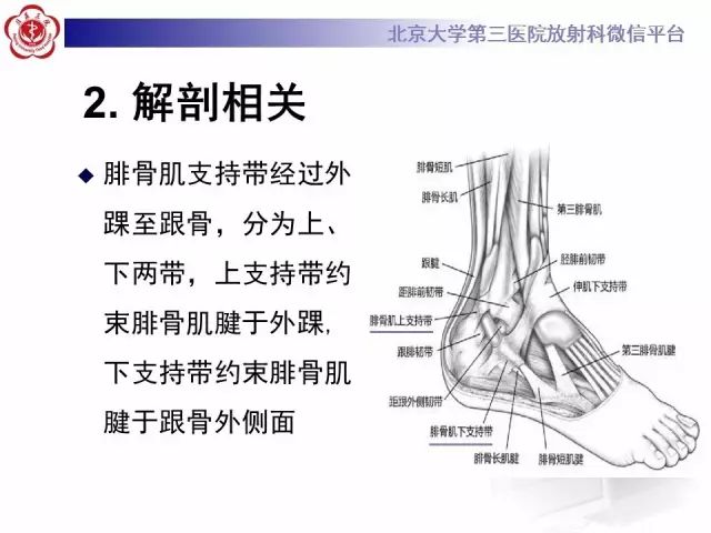 影像PPT - 【PPT】腓骨肌腱脱位的影像-14