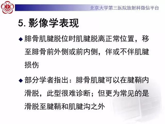 影像PPT - 【PPT】腓骨肌腱脱位的影像-20