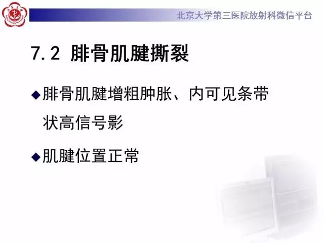 影像PPT - 【PPT】腓骨肌腱脱位的影像-28