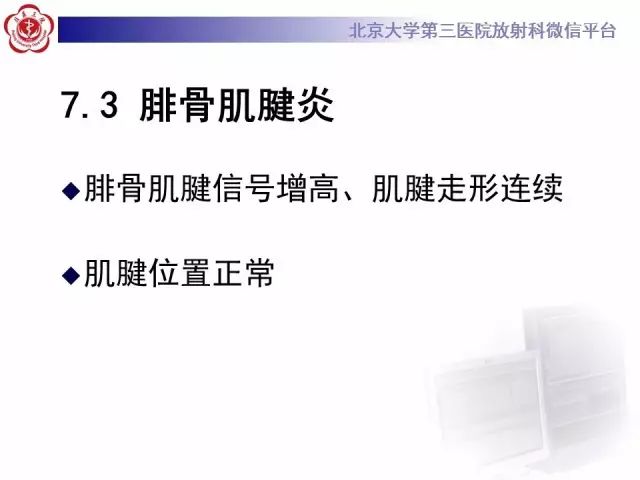 影像PPT - 【PPT】腓骨肌腱脱位的影像-31