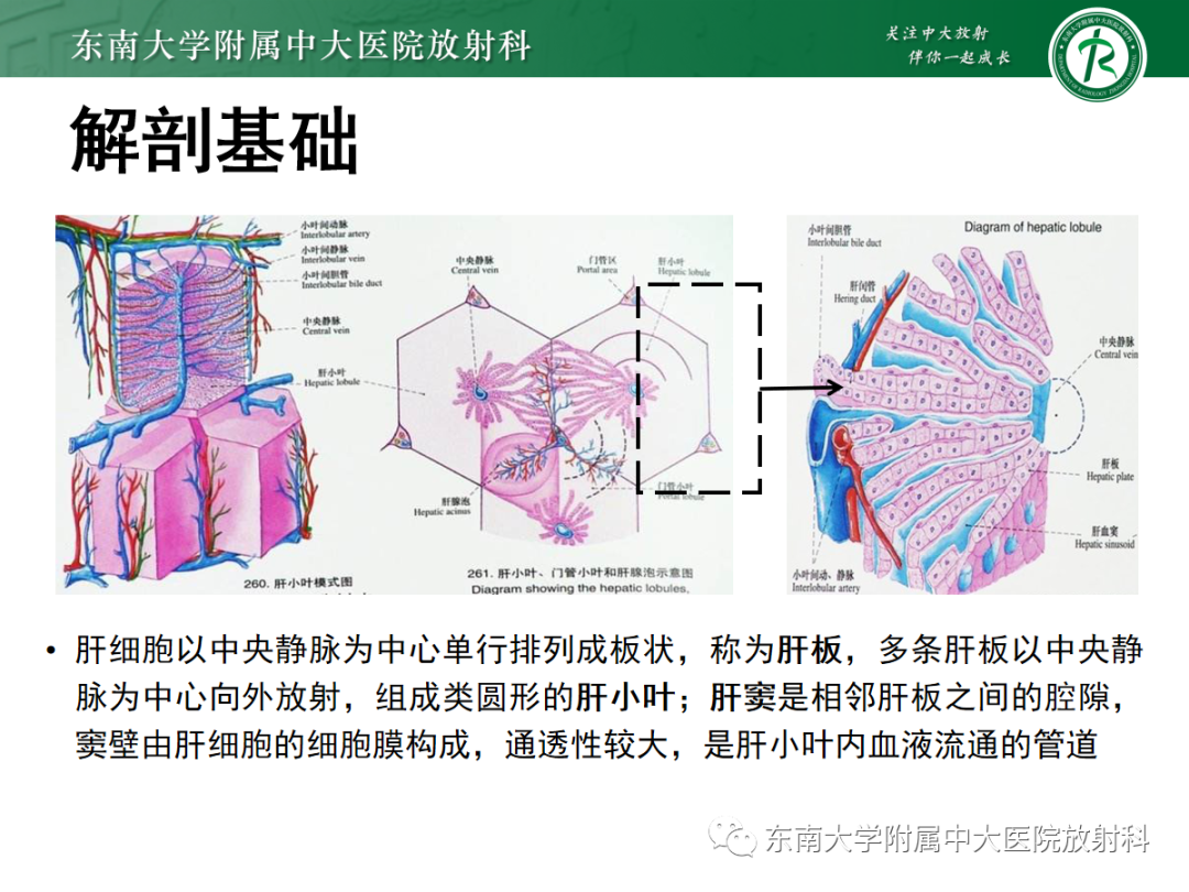 影像PPT - 【PPT】肝窦阻塞综合征的影像-5