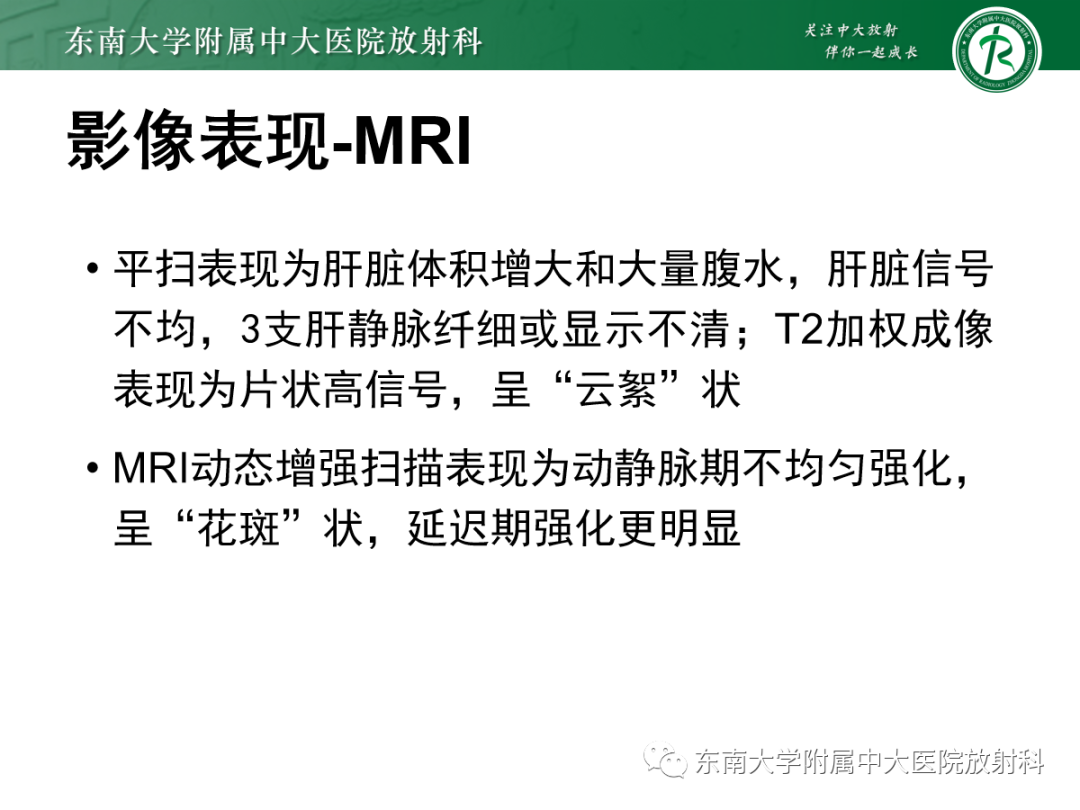 影像PPT - 【PPT】肝窦阻塞综合征的影像-12