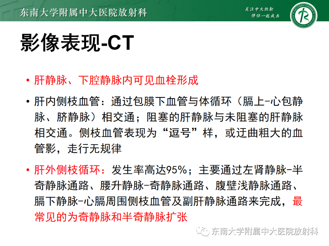 影像PPT - 【PPT】肝窦阻塞综合征的影像-19
