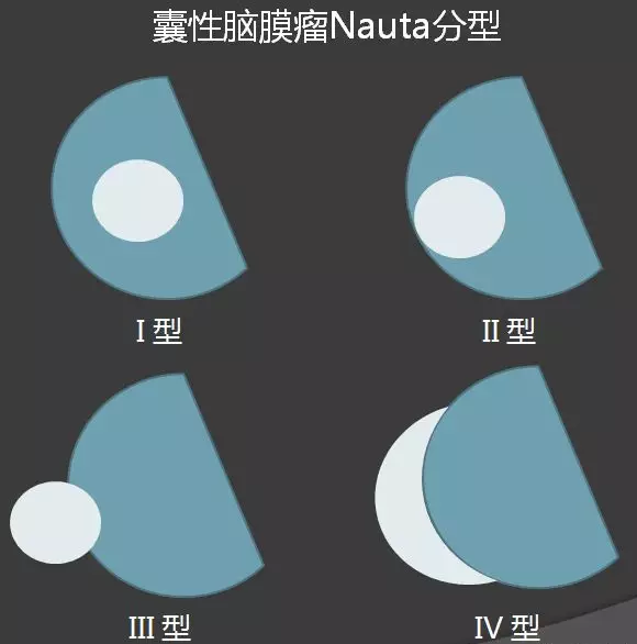 影像PPT - 【病例】常见疾病的不典型征象—囊性脑膜瘤1例MR-19 影像PPT - 【病例】常见疾病的不典型征象—囊性脑膜瘤1例MR-19