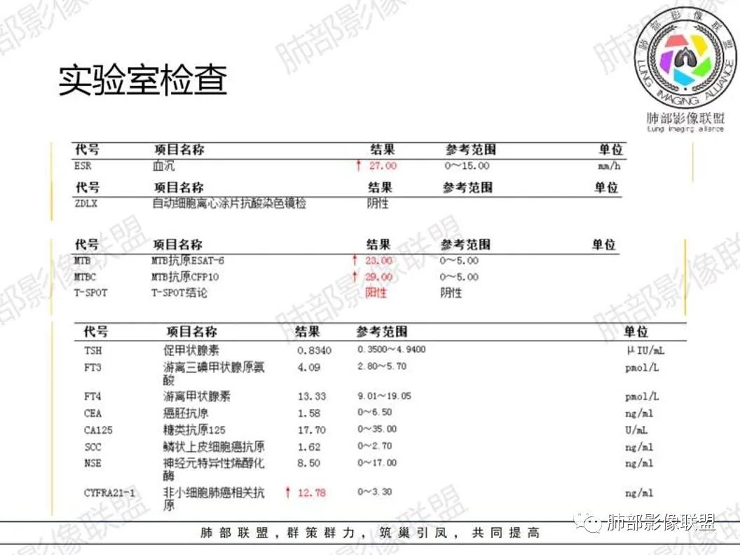 影像PPT - 【病例】 cyfra21-1?鉴别“鳞癌”与“结核”给您高招-4 影像PPT - 【病例】 cyfra21-1?鉴别“鳞癌”与“结核”给您高招-4