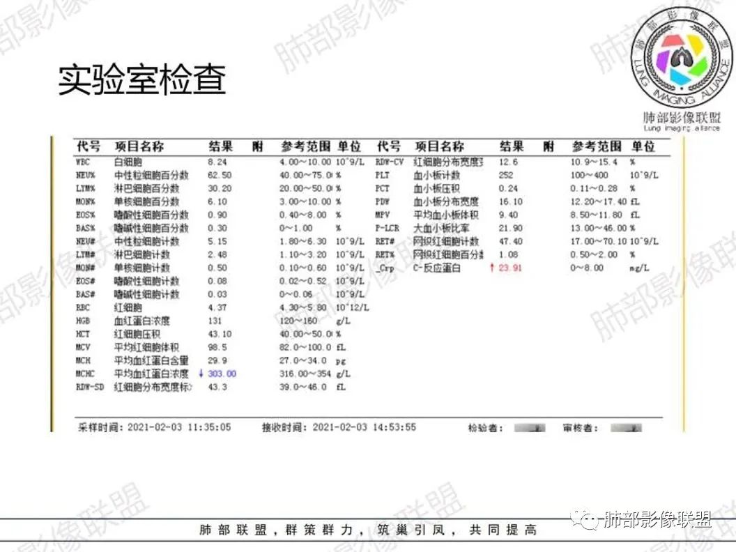 影像PPT - 【病例】 cyfra21-1?鉴别“鳞癌”与“结核”给您高招-3 影像PPT - 【病例】 cyfra21-1?鉴别“鳞癌”与“结核”给您高招-3