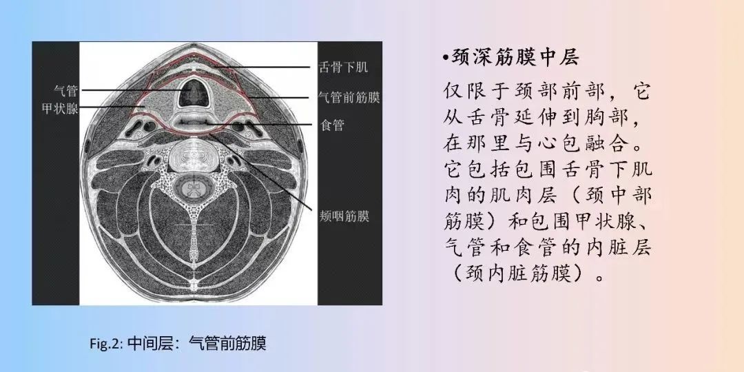 影像PPT - 【PPT】颈深部间隙感染的CT成像-10 影像PPT - 【PPT】颈深部间隙感染的CT成像-10