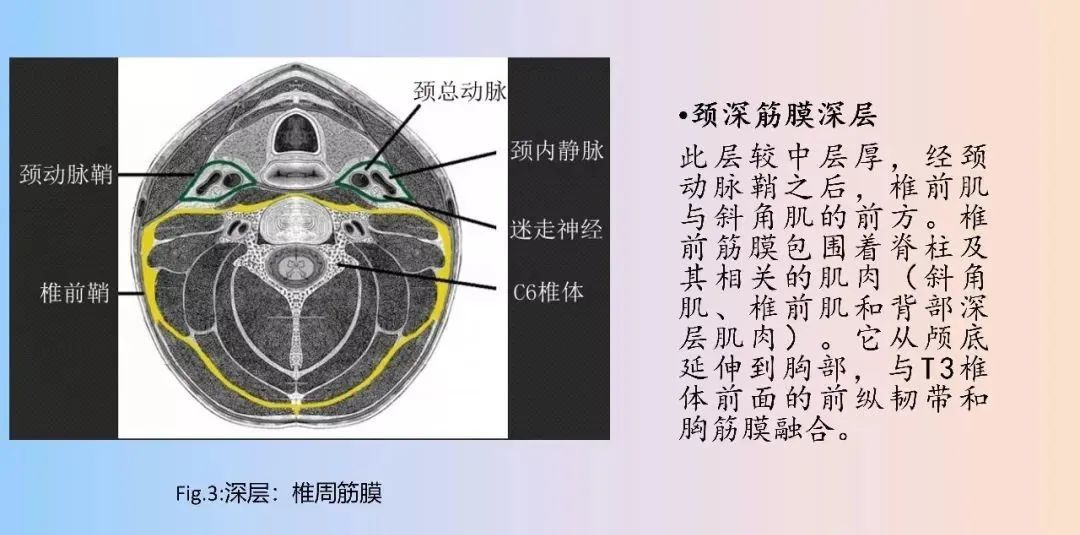 影像PPT - 【PPT】颈深部间隙感染的CT成像-11 影像PPT - 【PPT】颈深部间隙感染的CT成像-11