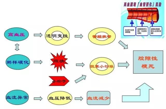 影像PPT - 腔隙性脑梗死诊疗中的9大雷区-1 影像PPT - 腔隙性脑梗死诊疗中的9大雷区-1