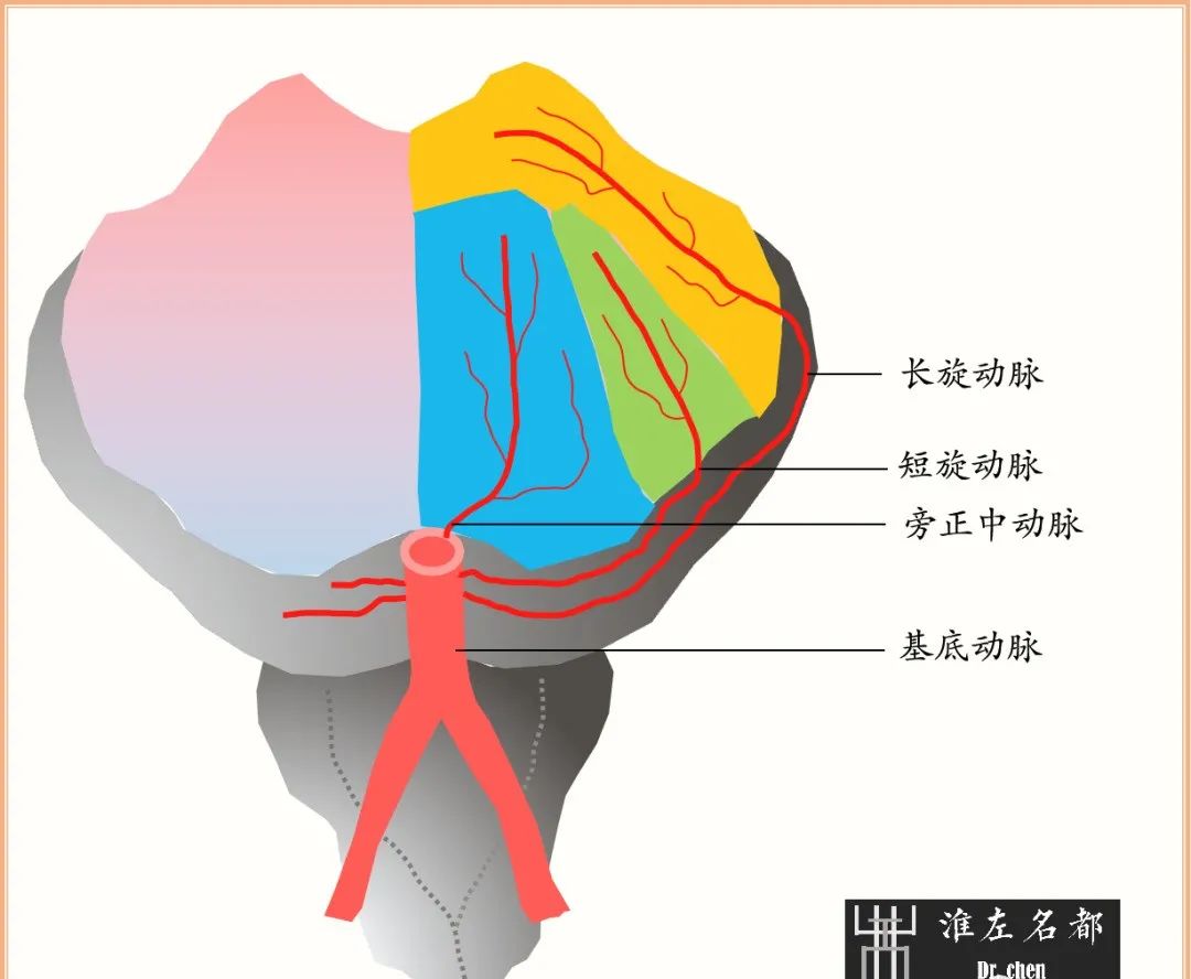 影像PPT - 图解脑桥梗死、豆纹动脉梗死机制 、解剖和示意图-1 影像PPT - 图解脑桥梗死、豆纹动脉梗死机制 、解剖和示意图-1