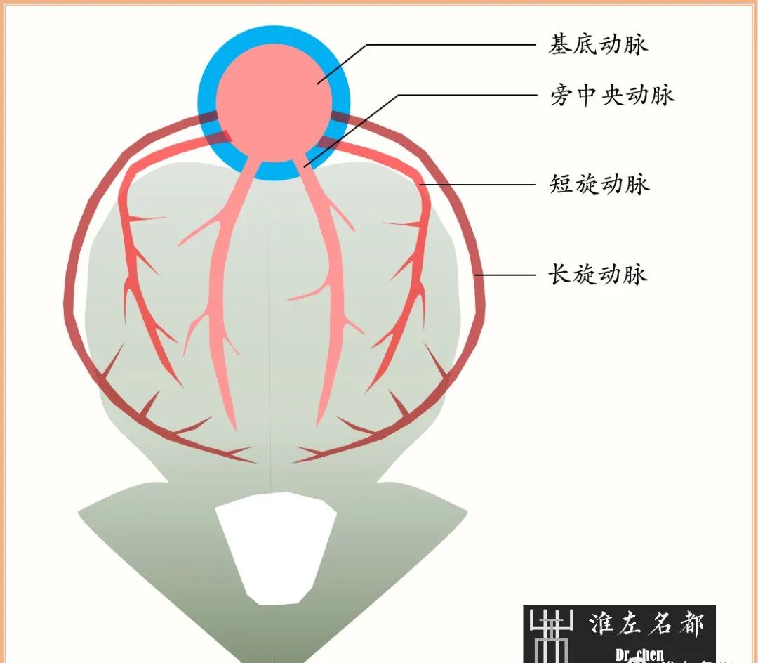 影像PPT - 图解脑桥梗死、豆纹动脉梗死机制 、解剖和示意图-2 影像PPT - 图解脑桥梗死、豆纹动脉梗死机制 、解剖和示意图-2