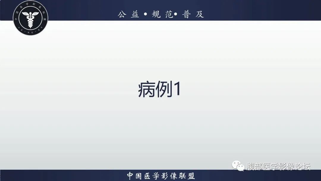 影像PPT - 【病例】左肾透明细胞肾癌1例CT影像-2