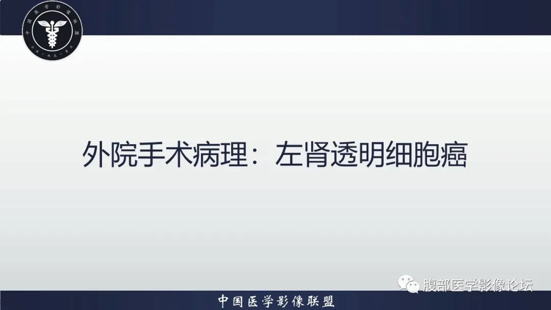 影像PPT - 【病例】左肾透明细胞肾癌1例CT影像-18