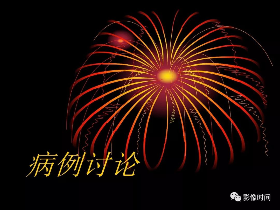 影像PPT - 【病例】鼻咽部淋巴瘤1例MR影像-1