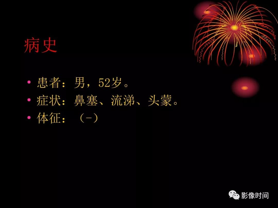 影像PPT - 【病例】鼻咽部淋巴瘤1例MR影像-2