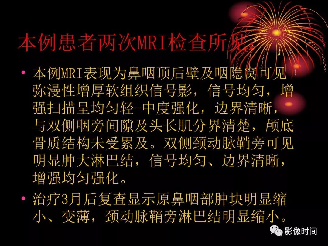 影像PPT - 【病例】鼻咽部淋巴瘤1例MR影像-17