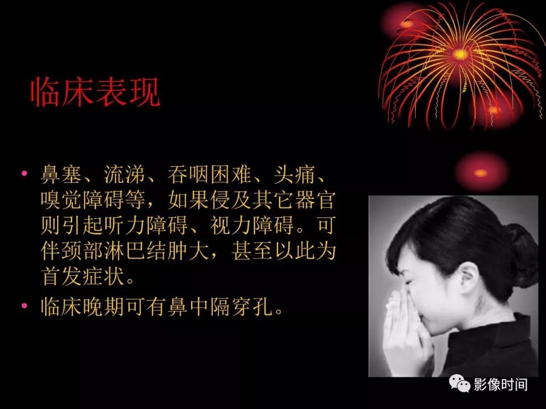 影像PPT - 【病例】鼻咽部淋巴瘤1例MR影像-21