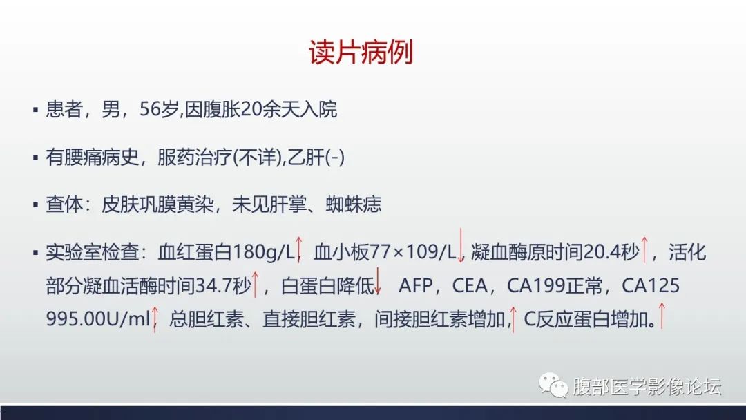 影像PPT - 【病例】肝窦阻塞综合征（肝小静脉闭塞病）CT及MR一例-2