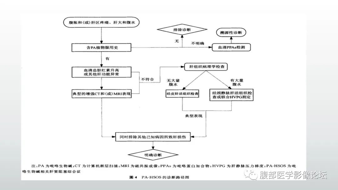影像PPT - 【病例】肝窦阻塞综合征（肝小静脉闭塞病）CT及MR一例-17