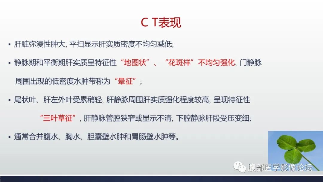 影像PPT - 【病例】肝窦阻塞综合征（肝小静脉闭塞病）CT及MR一例-19