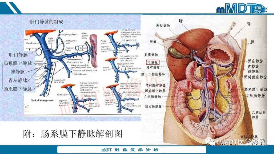 影像PPT - 【病例】肾透明细胞癌1例CT影像-23 影像PPT - 【病例】肾透明细胞癌1例CT影像-23