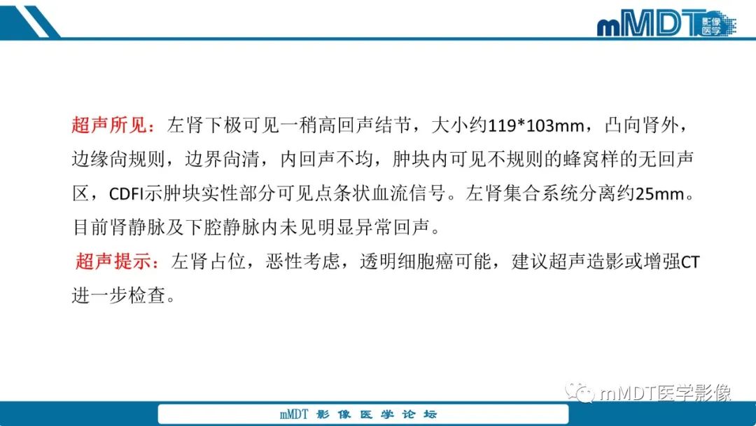 影像PPT - 【病例】肾透明细胞癌1例CT影像-31 影像PPT - 【病例】肾透明细胞癌1例CT影像-31