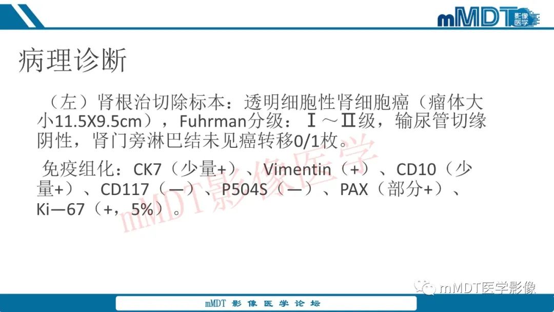影像PPT - 【病例】肾透明细胞癌1例CT影像-38 影像PPT - 【病例】肾透明细胞癌1例CT影像-38