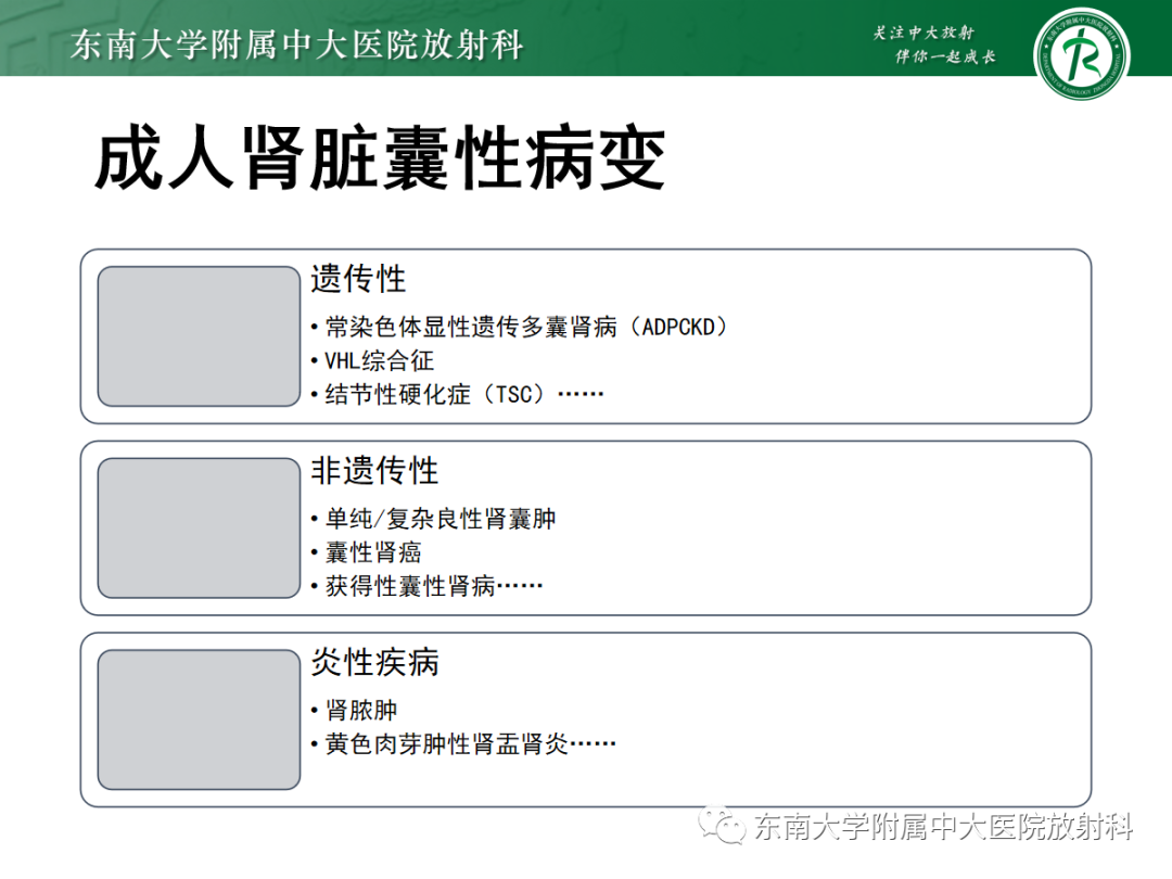 影像PPT - 【PPT】囊性肾癌的影像-6