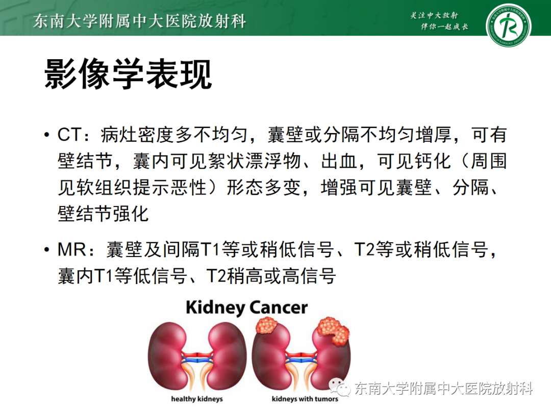 影像PPT - 【PPT】囊性肾癌的影像-7