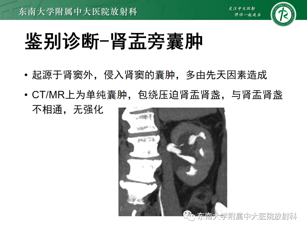 影像PPT - 【PPT】囊性肾癌的影像-19