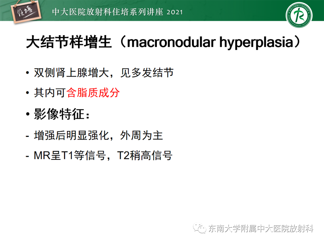 影像PPT - 【PPT】双侧肾上腺病变的影像诊断思路-26