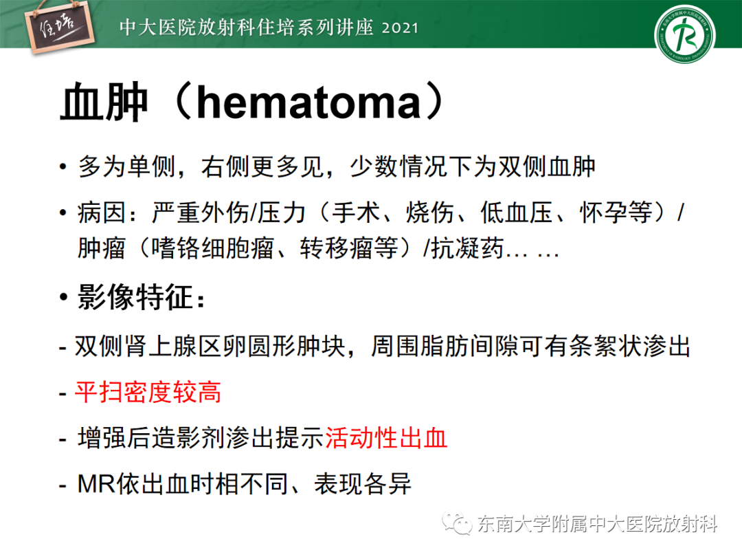影像PPT - 【PPT】双侧肾上腺病变的影像诊断思路-30