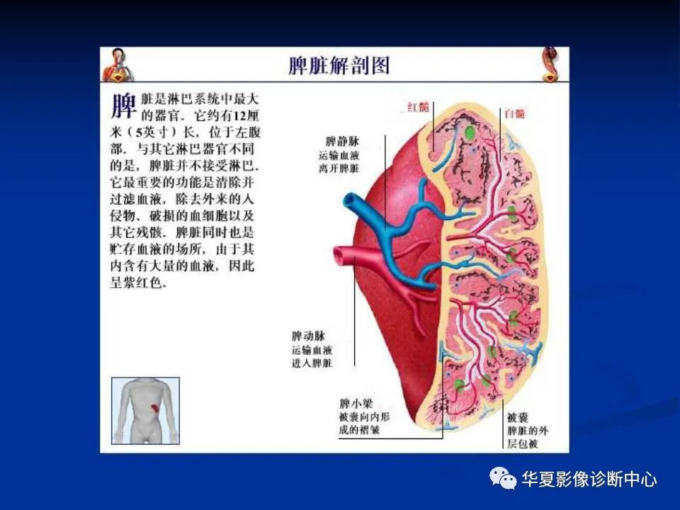 影像PPT - 【PPT】脾脏疾病CT诊断-5