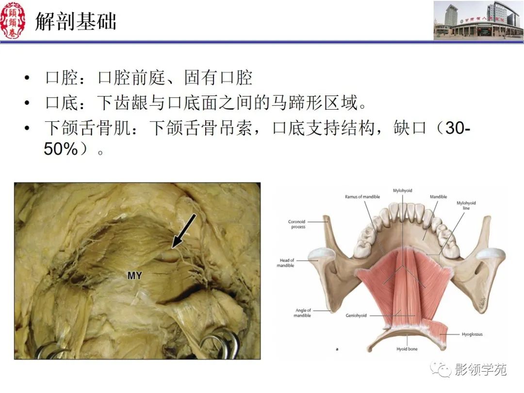 影像PPT - 【PPT】舌、口底影像解剖及常见疾病诊断-2