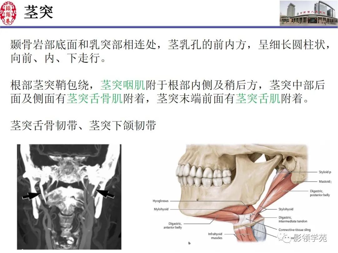 影像PPT - 【PPT】舌、口底影像解剖及常见疾病诊断-8