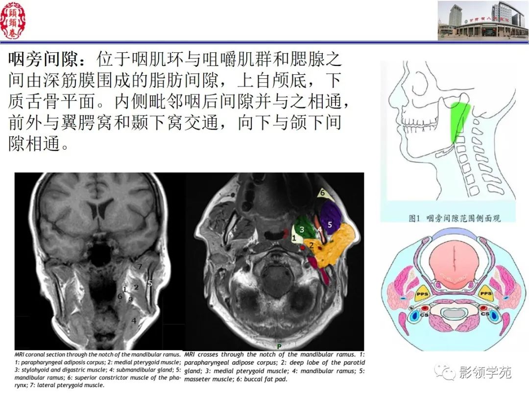 影像PPT - 【PPT】舌、口底影像解剖及常见疾病诊断-18