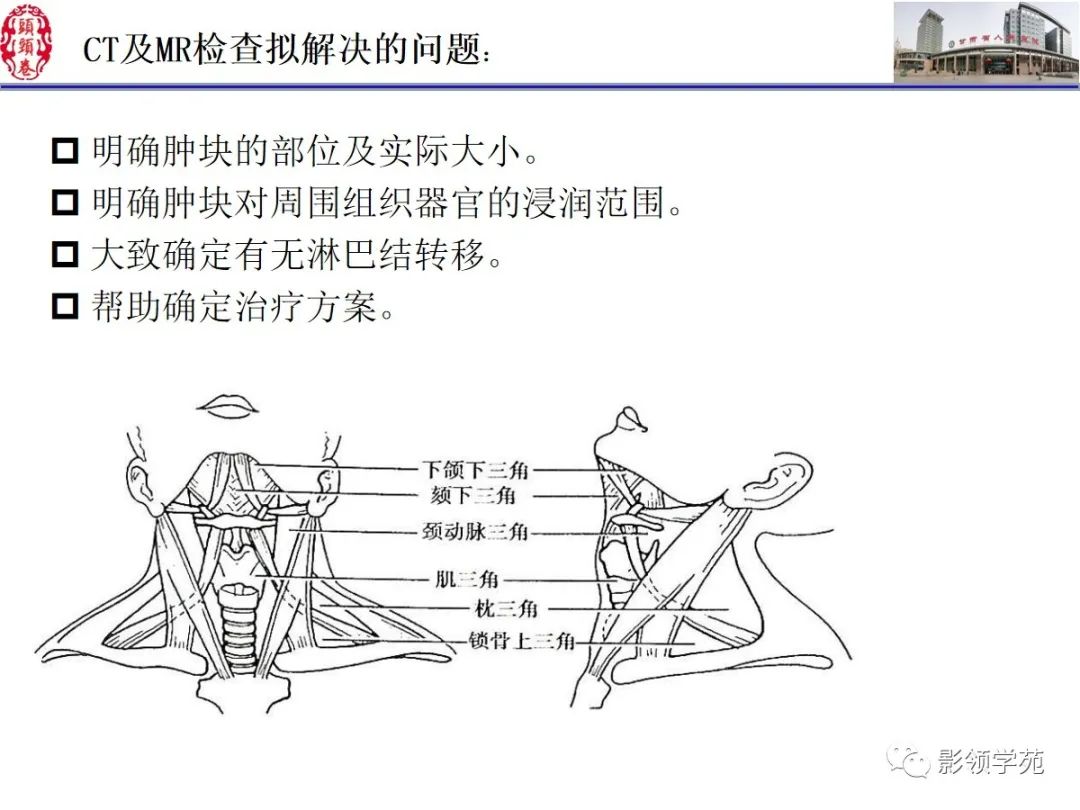影像PPT - 【PPT】舌、口底影像解剖及常见疾病诊断-72