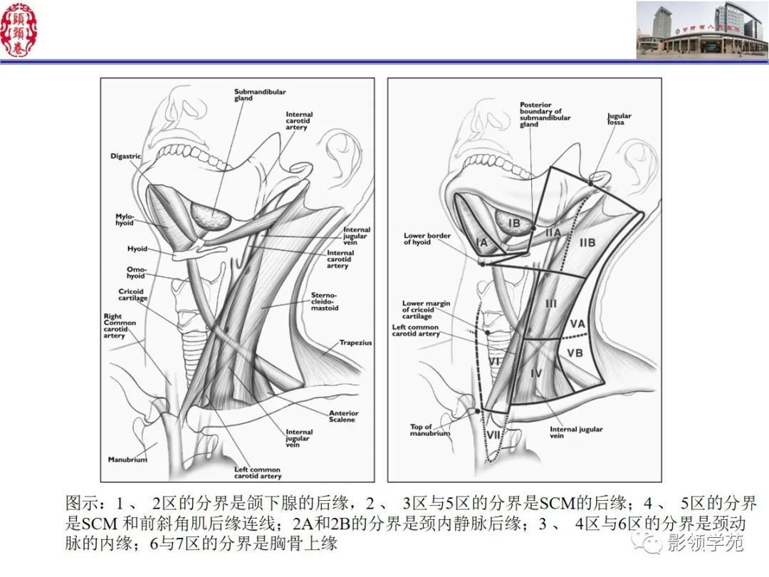 影像PPT - 【PPT】舌、口底影像解剖及常见疾病诊断-73