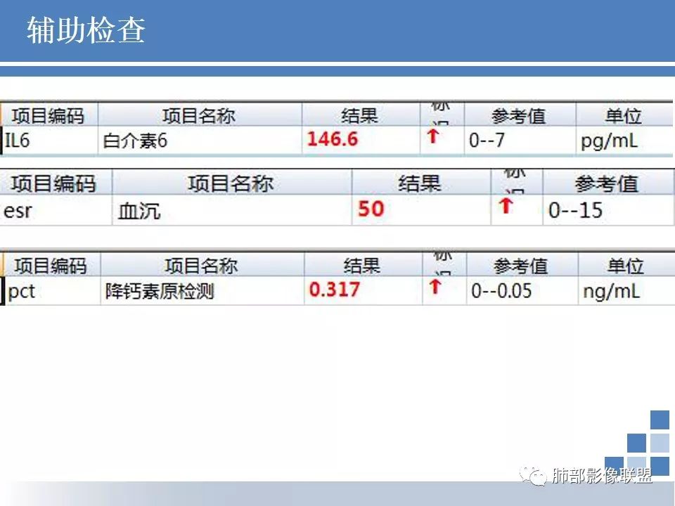 影像PPT - 【病例】结核千千面-2 影像PPT - 【病例】结核千千面-2